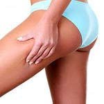 folk remedies for cellulite