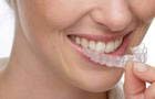 teeth whitening at home